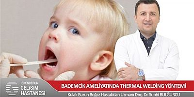 BADEMCİK AMELİYATINDA THERMAL WELDİNG YÖNTEMİ 