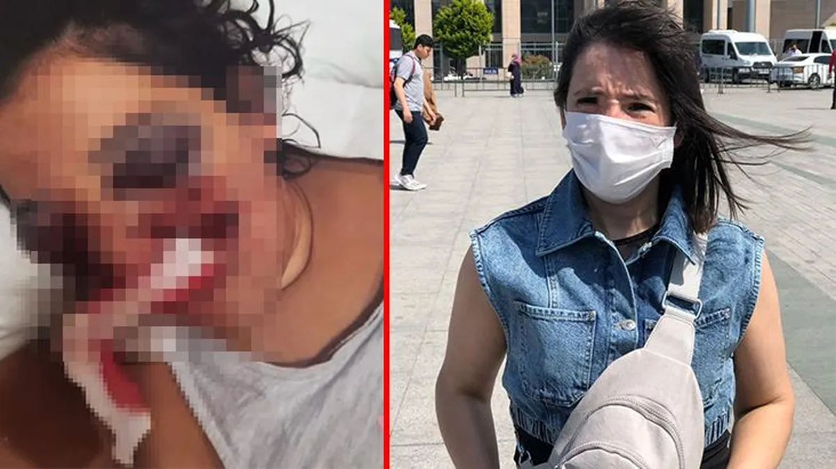 Tatilde ATV'ye bindi, sağ gözünü kaybetti! Yüzde 46 engelli kalan kadın şimdi adalet istiyor - Haberler